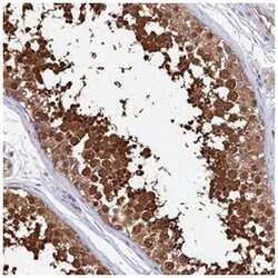 LDHC, Rabbit, Polyclonal Antibody, Abnova 100&mu;L; Unlabeled:Antibodies,