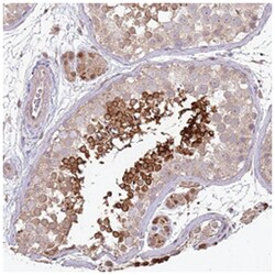 TSKS, Rabbit, Polyclonal Antibody, Abnova 100 &mu;L | Buy Online | Abnova Corporation | Fisher Scientific