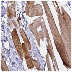 HAPLN2 Rabbit anti-Human, Polyclonal Antibody, Abnova 100 &mu;L | Buy Online | Abnova Corporation | Fisher Scientific