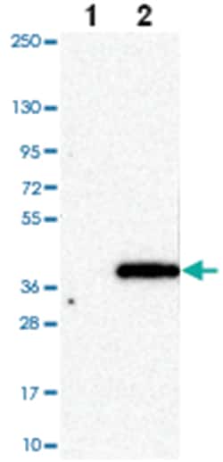 HAPLN2 Rabbit anti-Human, Polyclonal Antibody, Abnova 100 &mu;L | Buy Online | Abnova Corporation | Fisher Scientific