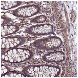 DUSP23 Rabbit anti-Human, Polyclonal Antibody, Abnova 100 &mu;L | Buy Online | Abnova Corporation | Fisher Scientific