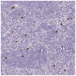 CD40LG Rabbit anti-Human, Polyclonal Antibody, Abnova 100&mu;L; Unlabeled:Antibodies,