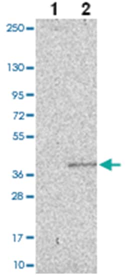 CD40LG Rabbit anti-Human, Polyclonal Antibody, Abnova 100&mu;L; Unlabeled:Antibodies,