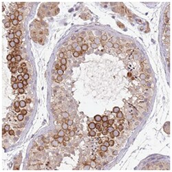 NMUR2 Rabbit anti-Human, Polyclonal Antibody, Abnova 100&mu;L; Unlabeled:Antibodies,