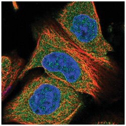 PDE4D Rabbit anti-Human, Polyclonal Antibody, Abnova 100&mu;L; Unlabeled:Antibodies,