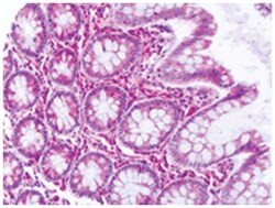 DUSP23 Rabbit anti-Human, Polyclonal Antibody, Abnova 50 &mu;g | Buy Online | Abnova Corporation | Fisher Scientific