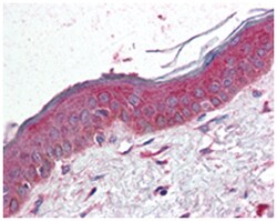 TSPAN6, Rabbit, Polyclonal Antibody, Abnova 50&mu;g; Unlabeled:Antibodies,