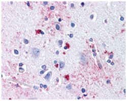 SLC29A1 Rabbit anti-Human, Polyclonal Antibody, Abnova 50 &mu;g | Buy Online | Abnova Corporation | Fisher Scientific