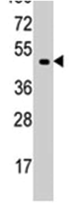 EIF4A1, Rabbit, Polyclonal Antibody, Abnova 400 &mu;L | Buy Online | Abnova Corporation | Fisher Scientific