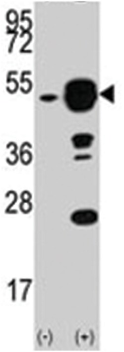 EIF4A1, Rabbit, Polyclonal Antibody, Abnova 400 &mu;L | Buy Online | Abnova Corporation | Fisher Scientific
