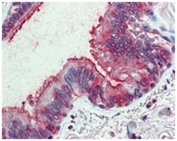 SLC44A2 Rabbit anti-Human, Polyclonal Antibody, Abnova 50&mu;g; Unlabeled:Antibodies,