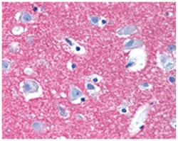 STX1A Rabbit anti-Bats, Bovine, Chicken, Dog, Hamster, Human, Monkey, Mouse, Pig, Rat, Polyclonal Antibody, Abnova 50 &mu;g | Buy Online | Abnova Corporation | Fisher Scientific