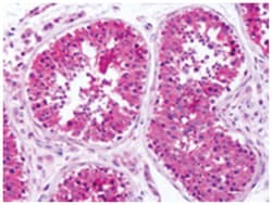 SLC1A4 Rabbit anti-Human, Monkey, Polyclonal Antibody, Abnova 50 &mu;g | Buy Online | Abnova Corporation | Fisher Scientific