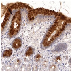 IFNGR2, Rabbit, Polyclonal Antibody, Abnova 100 &mu;L | Buy Online | Abnova Corporation | Fisher Scientific