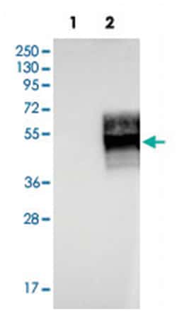 IFNGR2, Rabbit, Polyclonal Antibody, Abnova 100 &mu;L | Buy Online | Abnova Corporation | Fisher Scientific