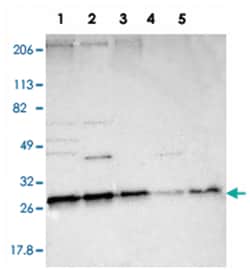 STX8, Rabbit, Polyclonal Antibody, Abnova 100 &mu;L | Buy Online | Abnova Corporation | Fisher Scientific