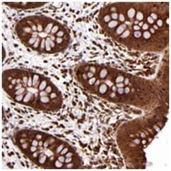 STX8, Rabbit, Polyclonal Antibody, Abnova 100 &mu;L | Buy Online | Abnova Corporation | Fisher Scientific