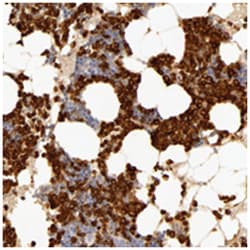 C1R, Rabbit, Polyclonal Antibody, Abnova 100&mu;L; Unlabeled:Antibodies,