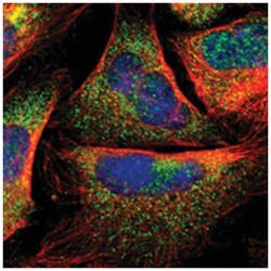 C1R, Rabbit, Polyclonal Antibody, Abnova 100&mu;L; Unlabeled:Antibodies,