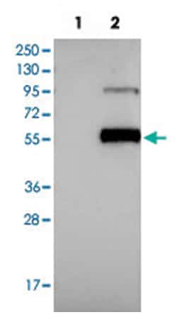 C1R, Rabbit, Polyclonal Antibody, Abnova 100&mu;L; Unlabeled:Antibodies,