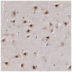 INTS6 Rabbit anti-Human, Polyclonal Antibody, Abnova 100 &mu;L | Buy Online | Abnova Corporation | Fisher Scientific