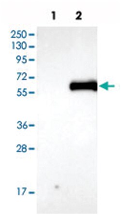 AGT Rabbit anti-Human, Polyclonal Antibody, Abnova 100&mu;L; Unlabeled:Antibodies,
