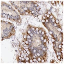 PLA2G6, Rabbit, Polyclonal Antibody, Abnova 100&mu;L; Unlabeled:Antibodies,