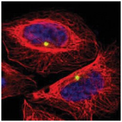 PLA2G6, Rabbit, Polyclonal Antibody, Abnova 100&mu;L; Unlabeled:Antibodies,