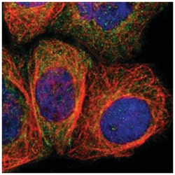 AMOTL1, Rabbit, Polyclonal Antibody, Abnova 100 &mu;L | Buy Online | Abnova Corporation | Fisher Scientific