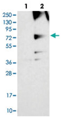 RNF139, Rabbit, Polyclonal Antibody, Abnova 100&mu;L; Unlabeled:Antibodies,