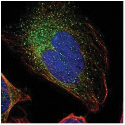 GAL3ST1, Rabbit, Polyclonal Antibody, Abnova 100&mu;L; Unlabeled:Antibodies,