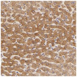 CBS, Rabbit, Polyclonal Antibody, Abnova 100 &mu;L | Buy Online | Abnova Corporation | Fisher Scientific