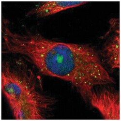 CBS, Rabbit, Polyclonal Antibody, Abnova 100 &mu;L | Buy Online | Abnova Corporation | Fisher Scientific