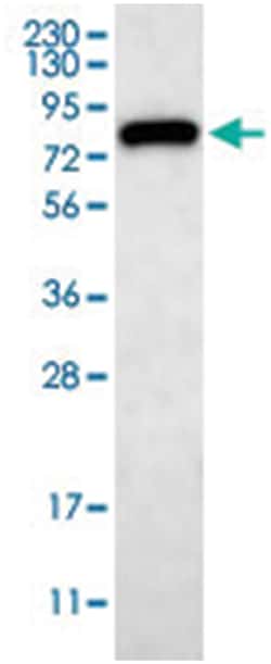 PLOD3, Rabbit, Polyclonal Antibody, Abnova 100 &mu;L | Buy Online | Abnova Corporation | Fisher Scientific