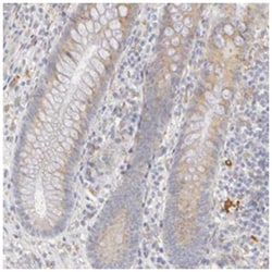 PLOD3, Rabbit, Polyclonal Antibody, Abnova 100 &mu;L | Buy Online | Abnova Corporation | Fisher Scientific