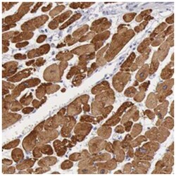 MYH7, Rabbit, Polyclonal Antibody, Abnova 100&mu;L; Unlabeled:Antibodies,