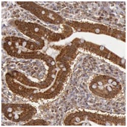 MPST, Rabbit, Polyclonal Antibody, Abnova 100&mu;L; Unlabeled:Antibodies,