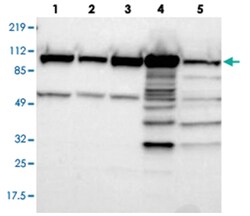 MTHFD1, Rabbit, Polyclonal Antibody, Abnova 100 &mu;L | Buy Online | Abnova Corporation | Fisher Scientific