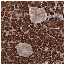 MTHFD1, Rabbit, Polyclonal Antibody, Abnova 100 &mu;L | Buy Online | Abnova Corporation | Fisher Scientific