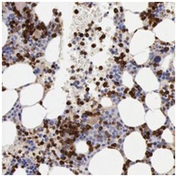 FCN1, Rabbit, Polyclonal Antibody, Abnova 100&mu;L; Unlabeled:Antibodies,