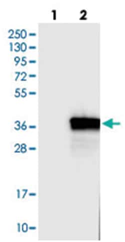 FCN1, Rabbit, Polyclonal Antibody, Abnova 100&mu;L; Unlabeled:Antibodies,