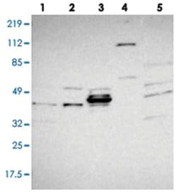 TRIB2, Rabbit, Polyclonal Antibody, Abnova 100 &mu;L | Buy Online | Abnova Corporation | Fisher Scientific