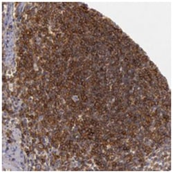 TRIB2, Rabbit, Polyclonal Antibody, Abnova 100 &mu;L | Buy Online | Abnova Corporation | Fisher Scientific