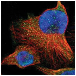 TRIB2, Rabbit, Polyclonal Antibody, Abnova 100 &mu;L | Buy Online | Abnova Corporation | Fisher Scientific