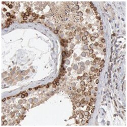 OSBPL8, Rabbit, Polyclonal Antibody, Abnova 100 &mu;L | Buy Online | Abnova Corporation | Fisher Scientific