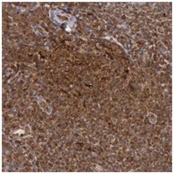 TAP2, Rabbit, Polyclonal Antibody, Abnova 100 &mu;L | Buy Online | Abnova Corporation | Fisher Scientific