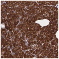 STX5, Rabbit, Polyclonal Antibody, Abnova 100 &mu;L | Buy Online | Abnova Corporation | Fisher Scientific