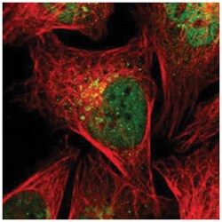STX5, Rabbit, Polyclonal Antibody, Abnova 100 &mu;L | Buy Online | Abnova Corporation | Fisher Scientific