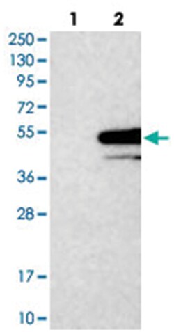 STX5, Rabbit, Polyclonal Antibody, Abnova 100 &mu;L | Buy Online | Abnova Corporation | Fisher Scientific