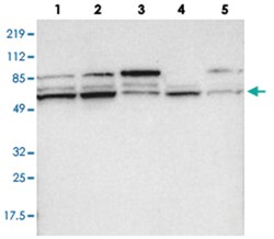 PCTK1 Rabbit anti-Human, Mouse, Rat, Polyclonal Antibody, Abnova 100&mu;L;